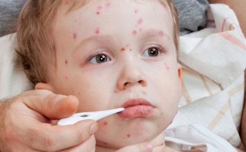 Summer Diseases in Children