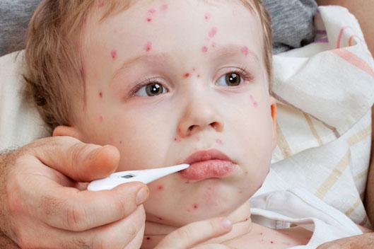 Summer Diseases in Children
