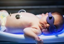 7 Remedies of Jaundice in New Born Babies