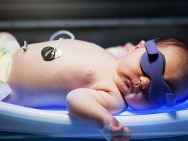 7 Remedies of Jaundice in New Born Babies