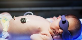 7 Remedies of Jaundice in New Born Babies