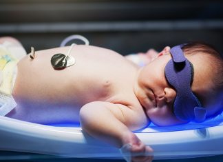 7 Remedies of Jaundice in New Born Babies