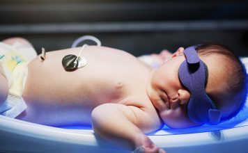 7 Remedies of Jaundice in New Born Babies