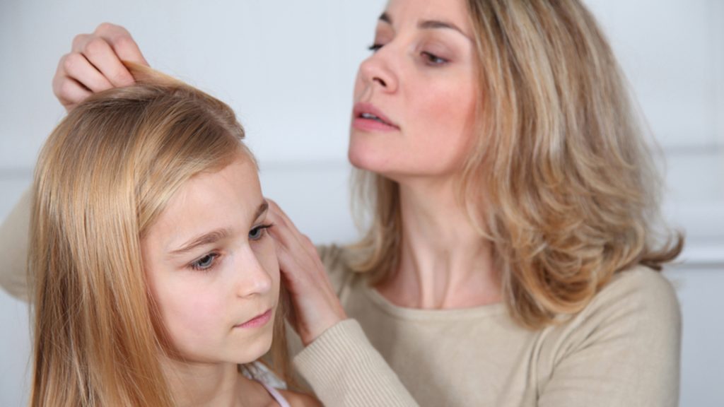 11 Natural Ways to get rid of lice in children