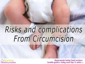 Circumcising Baby Boys: Risks and Complications