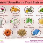 Natural remedies to treat boils in kids