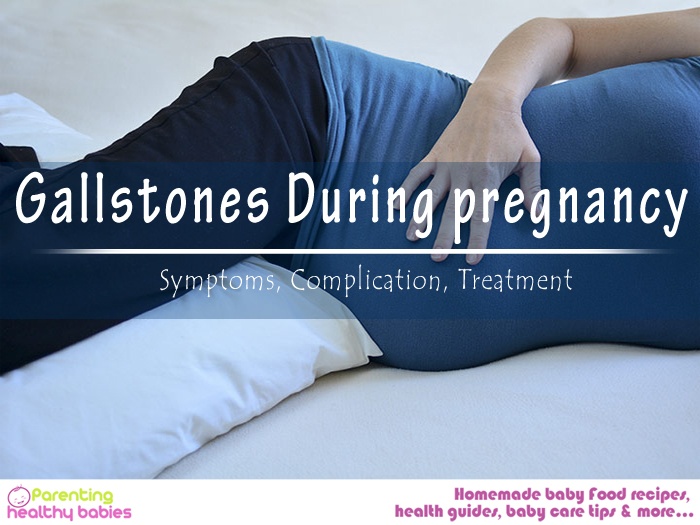 Gallstones in pregnant women