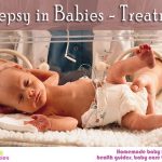 Epilepsy in babies – treatment