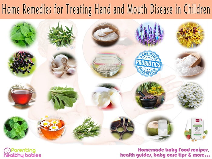 hand and mouth disease (1)