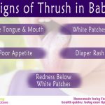 5 Signs of Thrush in Babies