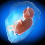 Low amniotic fluid: Risks and treatment
