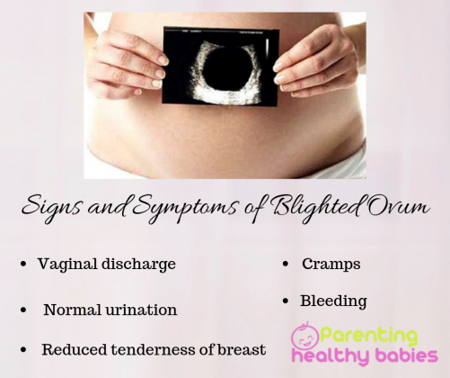 11 Best Tips For Rash Free Period Parentinghealthybabies 11-best-tips-for-rash-free-period-parentinghealthybabies