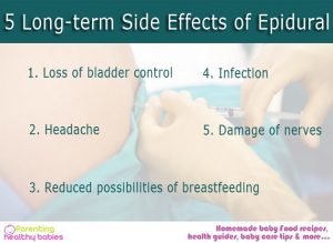 epidural side effects after birth