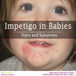 Impetigo in Babies: Signs and Symptoms