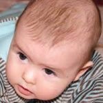11 easy home remedies for treating cradle cap in babies