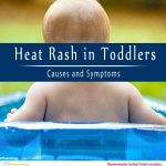 Heat Rash in Toddlers – Causes and Symptoms