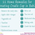 treating cradle cap in babies