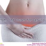 Symptoms and causes for cervical polyp