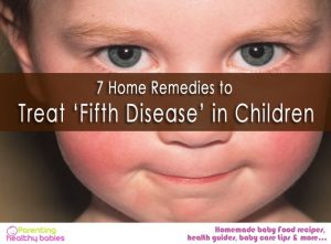 7 Home Remedies to Treat ‘Fifth Disease’ in Children
