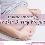 11 home remedies for itchy skin during pregnancy