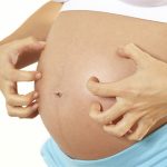 11 home remedies for itchy skin during pregnancy