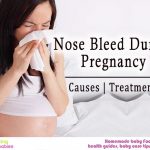 Nose bleed during pregnancy: causes and treatment