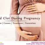 Blood Clot During Pregnancy: signs, causes, treatment, prevention