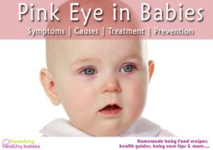 Pink Eye in Babies: Symptoms, Causes, Treatment and Prevention