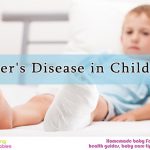 Sever’s Disease in Children