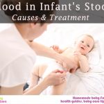 Blood in Infant’s Stool: Causes and Treatment