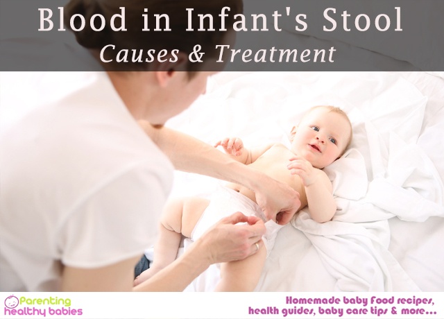 Blood in Infant's Stool