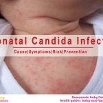 Neonatal Candida Infection: Cause, Symptoms, Risk, Prevention