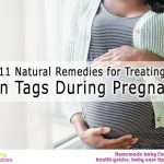 11 Natural Remedies for Treating Skin Tags During Pregnancy