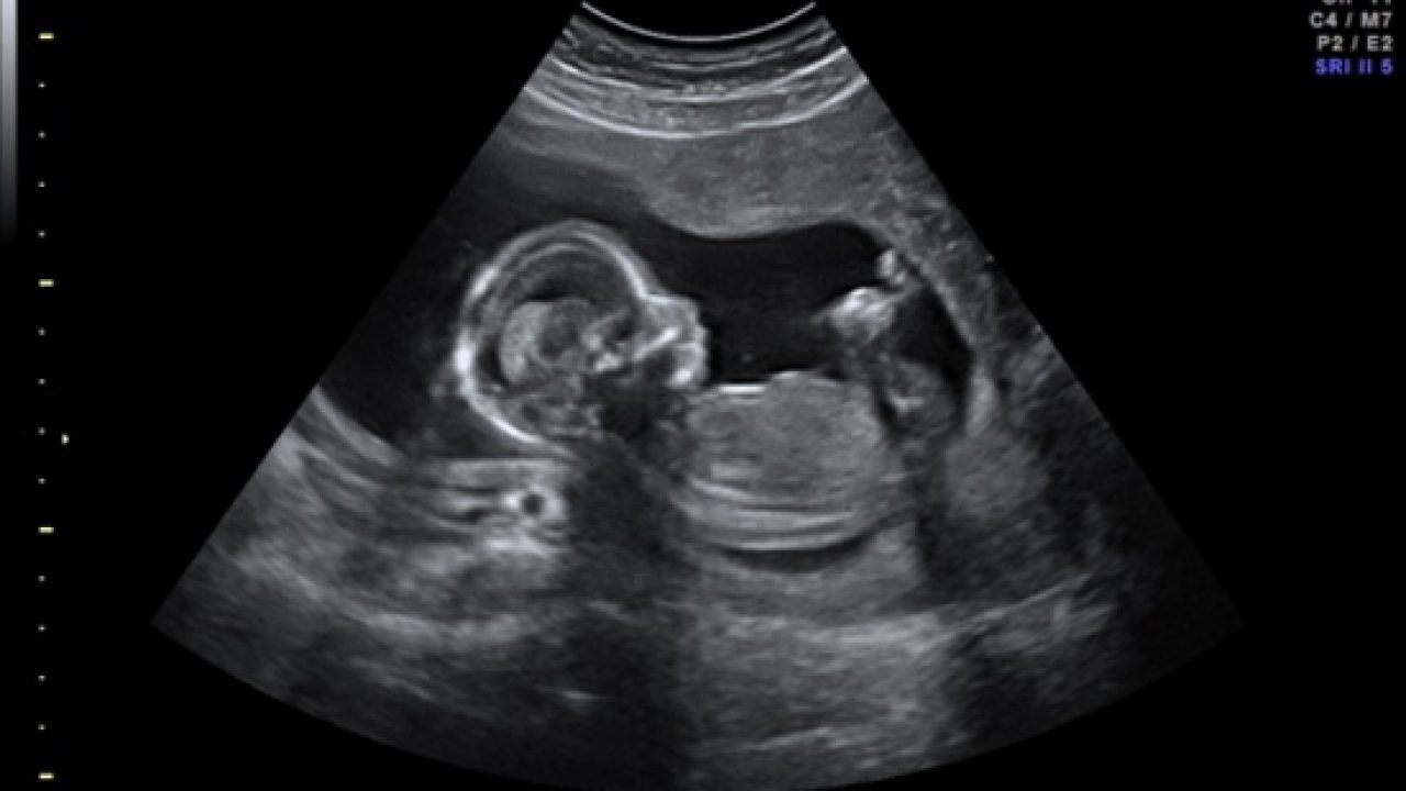 Фото плода в животе на 14 неделе беременности