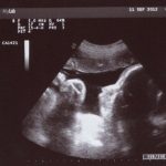 34 weeks pregnancy ultrasound