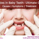 Cavities in Baby Teeth: Ultimate guide – Causes, Symptoms, Treatment