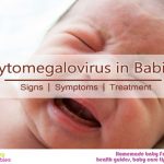 Cytomegalovirus in Babies