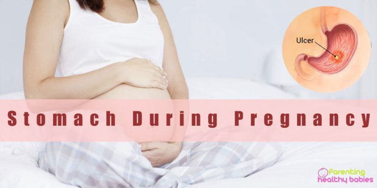 stomach-ulcer-during-pregnancy-ultimate-guide