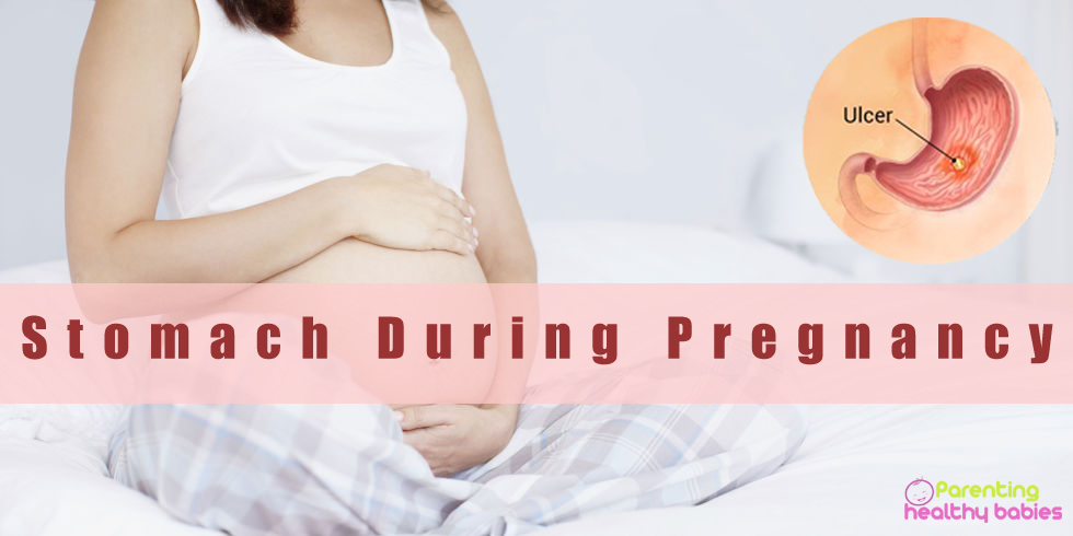 Stomach ulcer during pregnancy