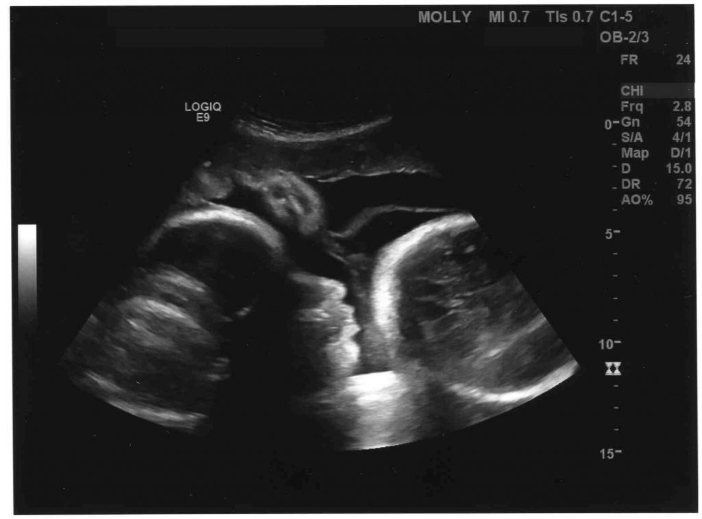 week 36 pregnancy ultrasound