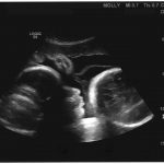 week 36 pregnancy ultrasound