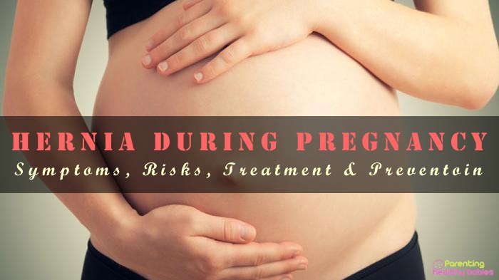 hernia during pregnancy
