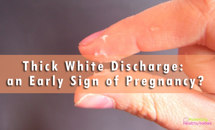Is White Discharge an Early sign of Pregnancy?