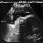 week 37 pregnancy ultrasound