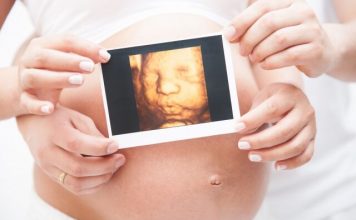 3D or 4D ultrasound