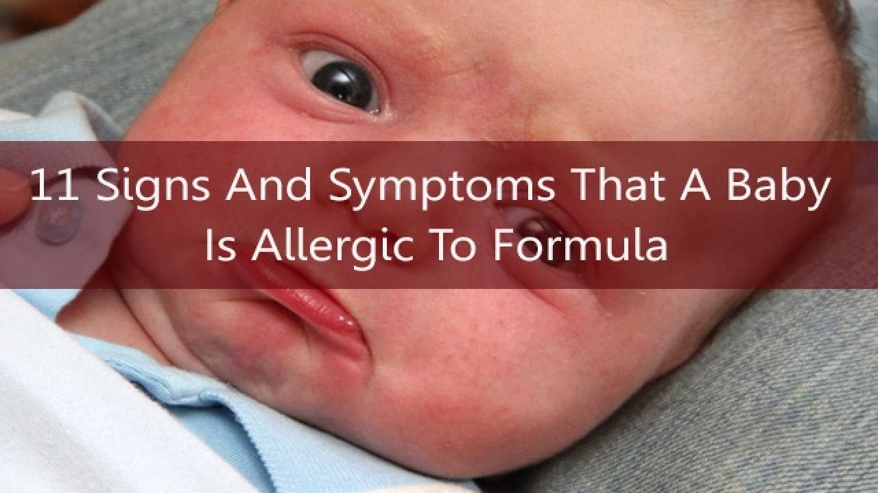 How do i know if baby allergic to formula