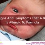 11 Signs And Symptoms That A Baby Is Allergic To Formula