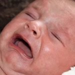 11 Signs And Symptoms That A Baby Is Allergic To Formula