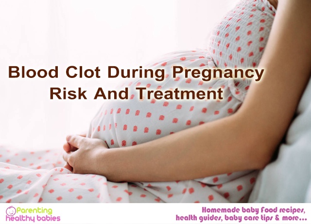 Blood Clot During Pregnancy