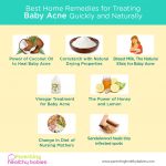 baby acne remedies